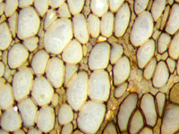 Psaronius xylem