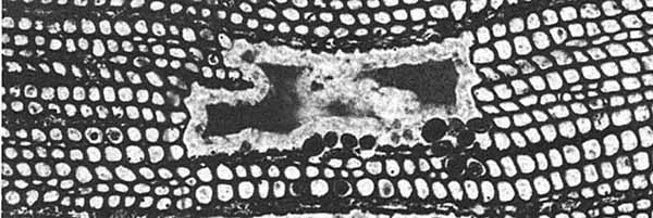 clots inside and outside wood cells