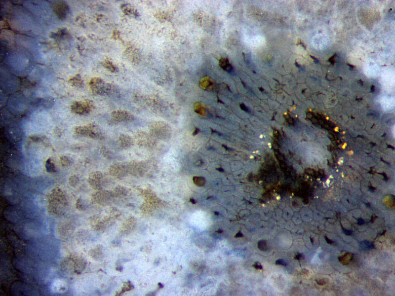 Ventarura cross-section