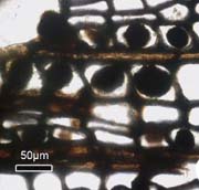 clots in cells