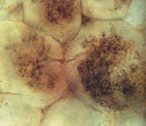 Pilzgeflecht als dunkle Fllung in Pflanzenzellen, nach H. Kerp