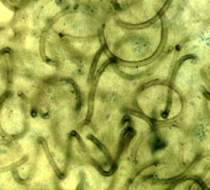 Nematoplexus rhyniensis, detail from the type specimen
