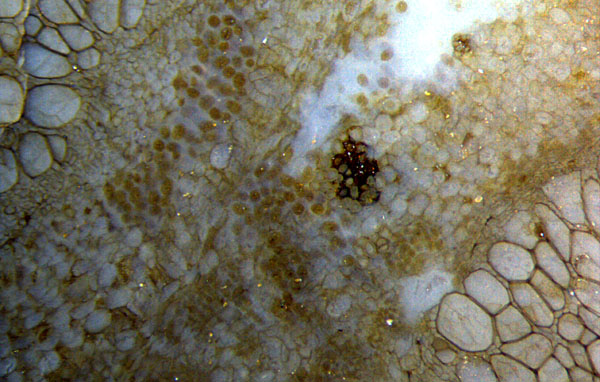 Psaronius centre tissues