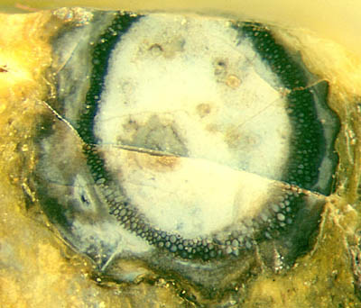 Ventarura cross-section with dark ring inside