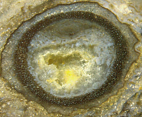 Ventarura ring