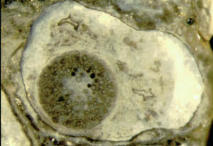 kugelige "Chlamydospore" angefllt mit kleinen Sporen