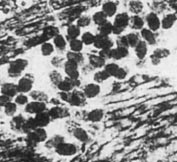 Clots misinterpreted as coprolites, Permian, Chemnitz