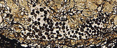 angular clots in cretaceous bennettitalean stem