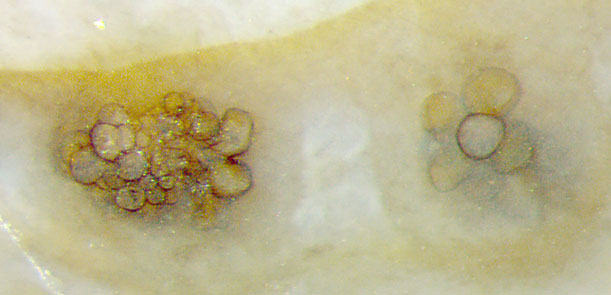 unknown fungus vesicles