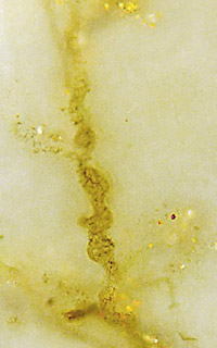 parasite hypha