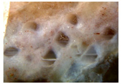 Cross-sections of Permian conifer needles with level bands inside