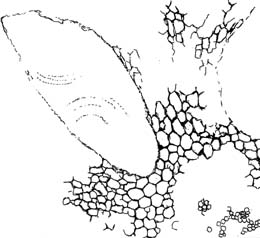 Detail of tissue with fungus-induced growth anomaly