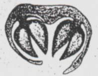 Scolecopteris pinnule cross-section, 1874