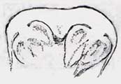 Scolecopteris pinnule cross-section after lectotype, 1995