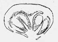 Scolecopteris pinnule cross-section, 1999