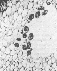 clots of various sizes and shapes fitting to the cells