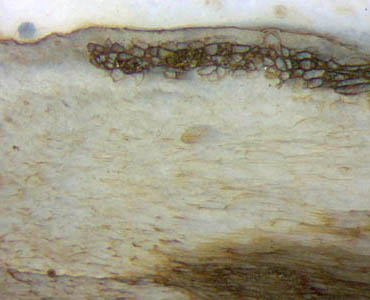 Aglaophyton "hollow straw" tissue